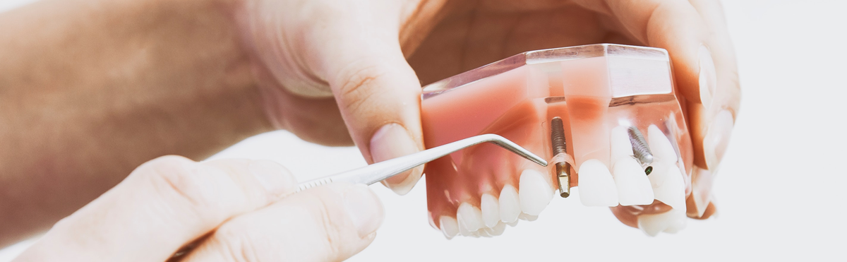 GIBZ Fachzahntechniker/in Kieferorthopädie eidg. Fachausweis